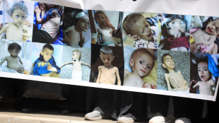 Msf, a Gaza un quarto dei bimbi e delle mamme è malnutrito