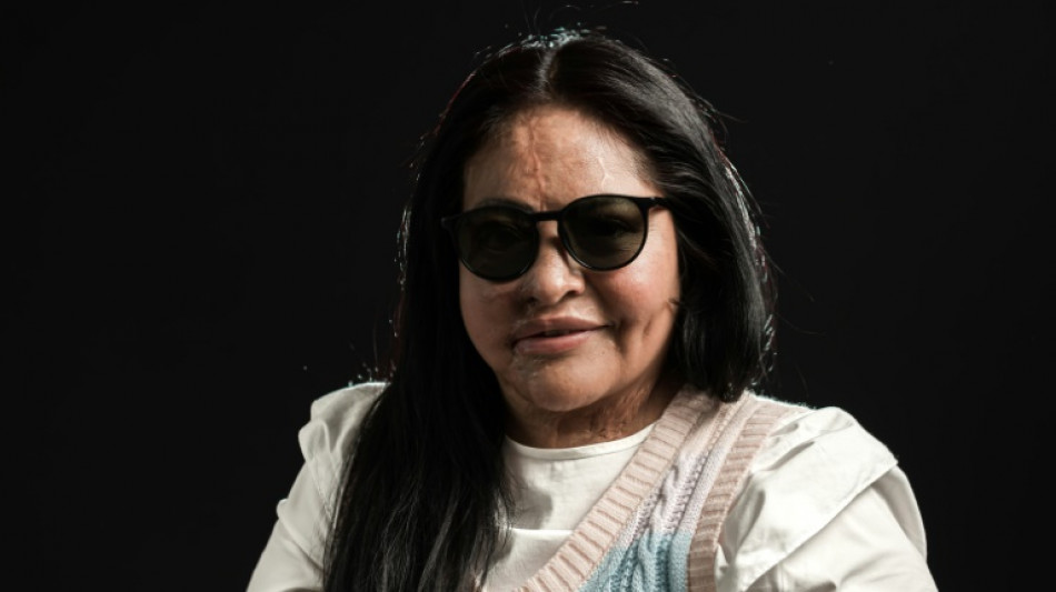 Ayudar para sanar: las mexicanas víctimas de la "violencia ácida"
