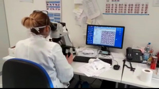 L'ovaio sa contare i suoi ovuli per tutto il ciclo riproduttivo