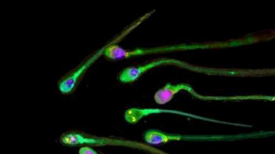 Anche gli spermatozoi hanno un orologio biologico, nascosto nel Rna