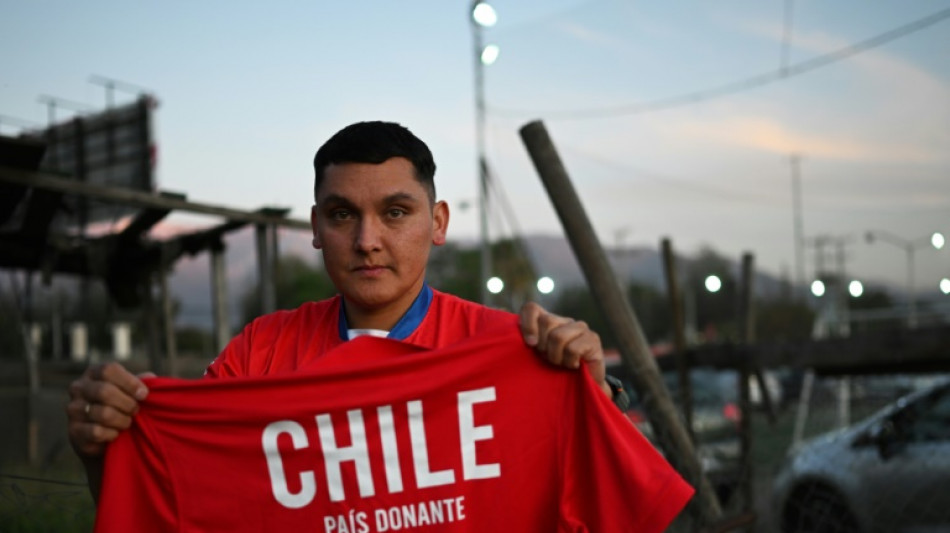 Transplantados, a equipe de futebol incomum que promove a doa&ccedil;&atilde;o de &oacute;rg&atilde;os no Chile